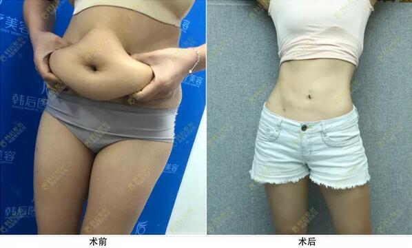 韩后：没时间去健身？这样做可以919你的身材！