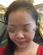 黑脸娃娃没果是真的吗?真人案例为你解惑 width=