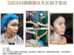 奥美定取出价格在什么范围比较合理? width=