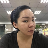 去颊脂垫有副作用吗?行家为了做较的解答