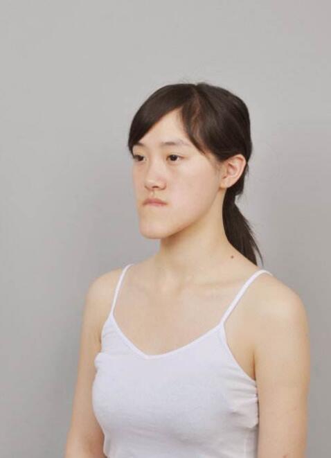 郭方圆现状如何?折翼天使也能展翅飞翔
