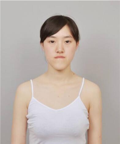 郭方圆现状如何?折翼天使也能展翅飞翔