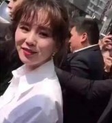 亲身经历，做了脂肪填充的你千万不能胖！ width=
