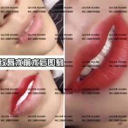 汕头华美整容医院纹唇、牙齿美白福利来了，放送免费体验名额！
