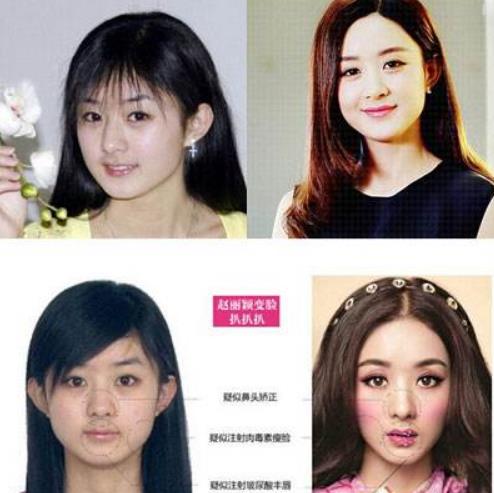 甩饼脸是什么样子的，可以参考哪位名人?