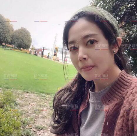 唇腭裂整形后的她，成为美到打破次元壁的女生！