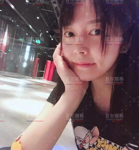 唇腭裂整形后的她，成为美到打破次元壁的女生！