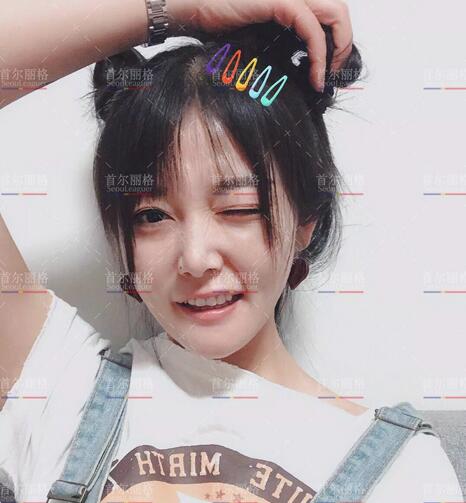 唇腭裂整形后的她，成为美到打破次元壁的女生！