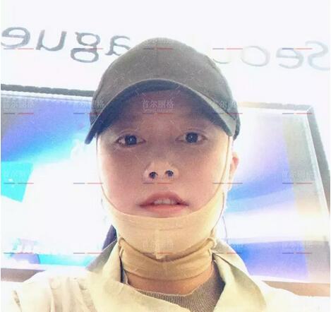 唇腭裂整形后的她，成为美到打破次元壁的女生！