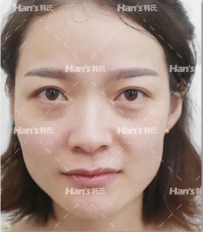 韩氏减肥劝退？不如看看三十几岁女性的正确抗衰日记~