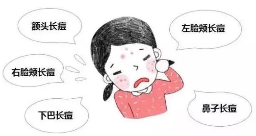 面部痤疮的调节方法