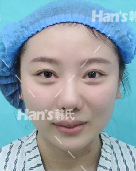 李承焕