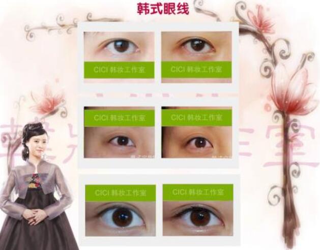 激光洗眼线会结痂吗?