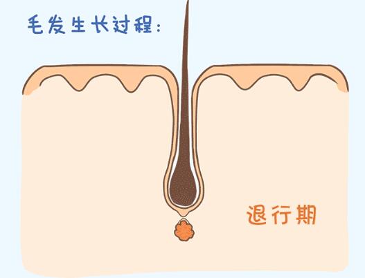 微创植发技术真的能让中国2亿的脱发人群脱离苦海吗？