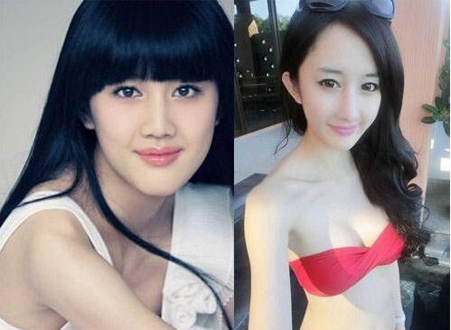 文梦洋整容前后反差如此之大，她到底整了那些部位?