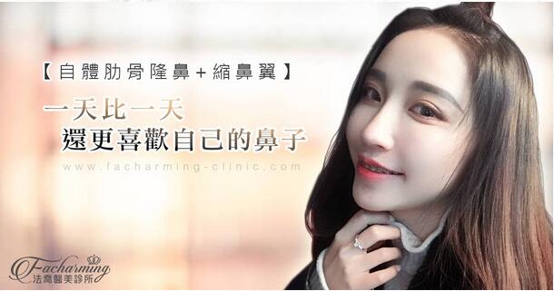 大连王艇隆鼻案例大方分享，你不要吝啬来看看哦！