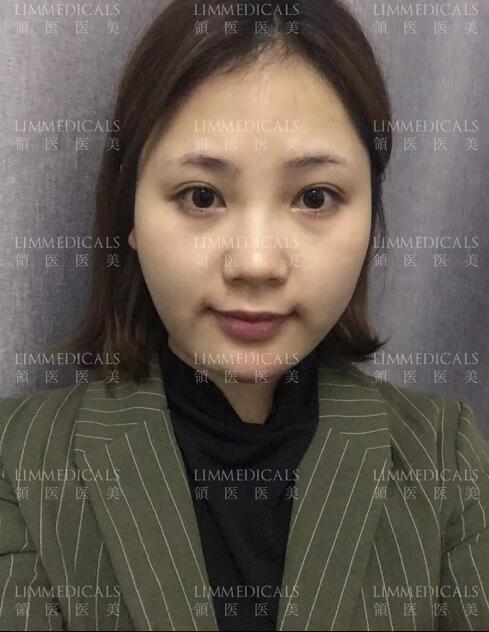 美联臣v脸女郎养成日记，一起来见证哇！