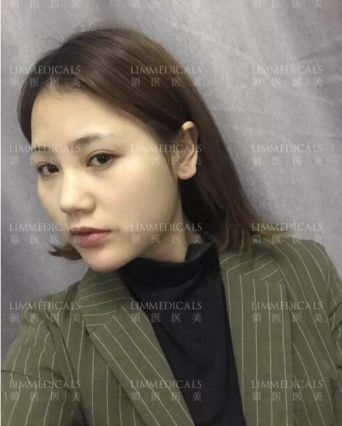 美联臣v脸女郎养成日记，一起来见证哇！
