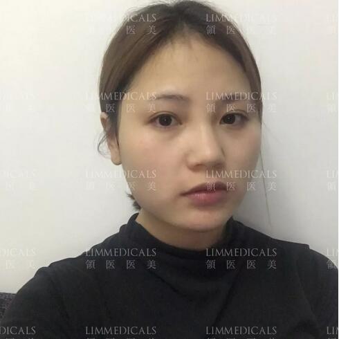 美联臣v脸女郎养成日记，一起来见证哇！
