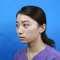 泉美整形郭龙泉医生到底擅长做什么?谁能告诉我