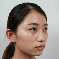 泉美整形郭龙泉医生到底擅长做什么?谁能告诉我
