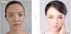 上海打美白价格大概是多少 width=