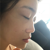 刘冬青院长整体实力如何?听说隆鼻很厉害?