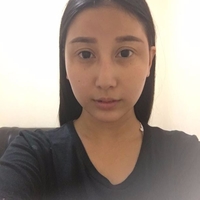 伊美尔长岛医院国字脸整形技术如何?真人案例展示