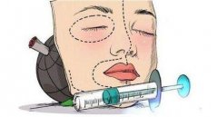 人工骨粉隆鼻有危害吗 width=