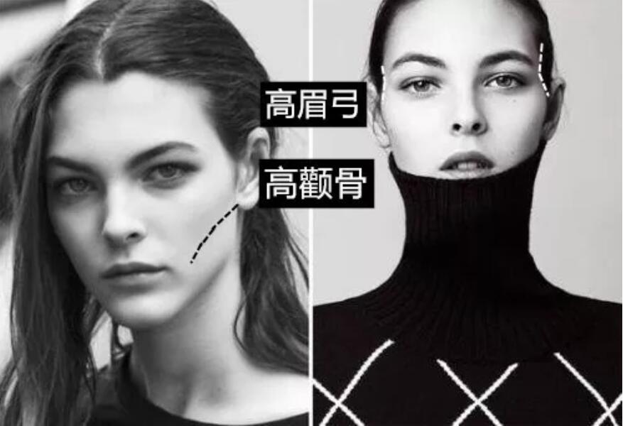 盘点了凹陷脸填充案例才发现，像王菲这样的脸绝不能这么填！！