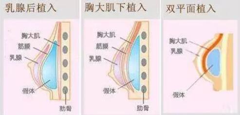 热点|No Bra，不穿内衣你敢吗？