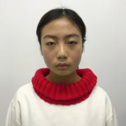 黄小闪双眼皮+垫下巴+美白案例分享~前后变化如此之大 width=