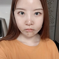 王良发整容技术如何?做磨骨瘦脸能找他吗?