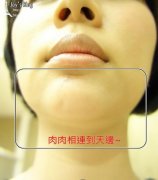 美联臣v脸女郎修饰轮廓线，瞬间成为大家追逐的女神！ width=