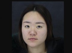 晏兵娴韩式翘睫双眼皮前后对比皂片：单眼皮双眼皮谁好看 width=