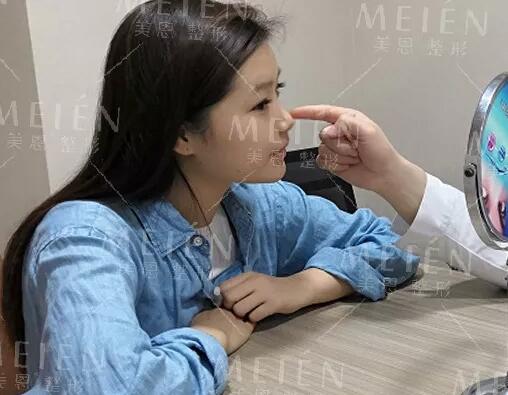 分段式假体隆鼻后30天撞脸张馨予？ 她的生活发生了什么变化？