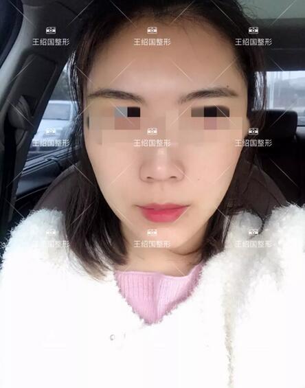 【王绍国面部加减法案例】——美的积极循环~