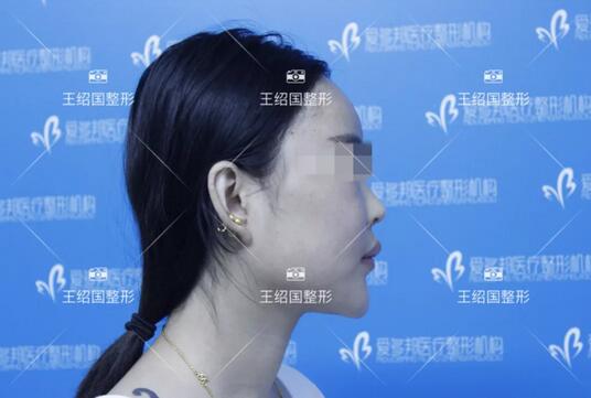 【王绍国案例】——别把健康当做儿戏~