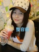 于文文整容前后对比照|小衰带各位详细了解她！ width=