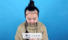“内地胡杏儿”发际线后移，种植发际线，告别大额头！ width=