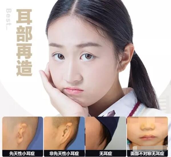 profile普罗菲耳：耳畸形患者是否一定要做听力重建手术？