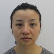 下巴吸脂恢复过程图片分享，从此告别双下巴 width=