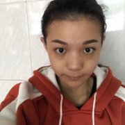 杭州同欣整形医院做隆鼻技术如何?能让我有个高挺的鼻子吗? width=