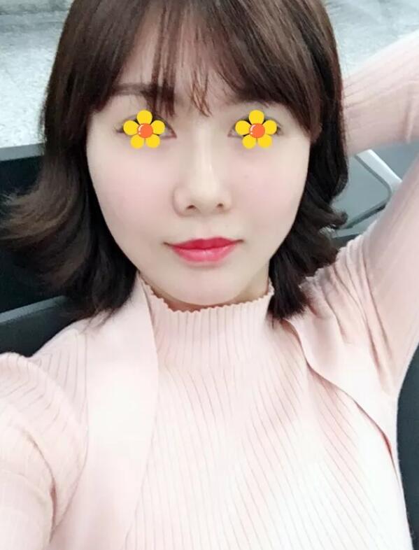 伊美尔吸脂