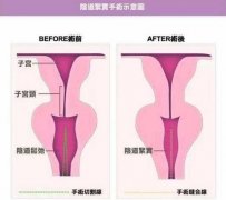 缩阴手术让我重回少女时代~ width=
