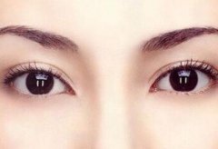 高分子埋线双眼皮价格大概多少? width=