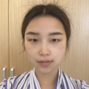 瑷珊下颌角整形案例分享，100天恢复果图展示~~ width=