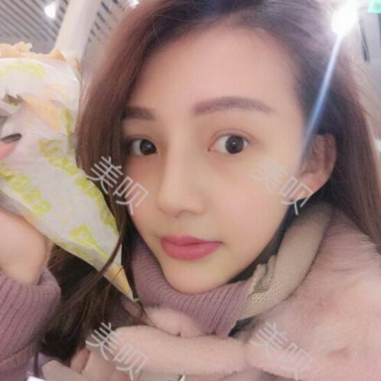 水滴鼻好看吗?我想去做个水滴鼻~~