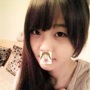 无锡同济整形医院做双眼皮技术怎么样?真实案例流出! width=