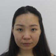 去颊脂垫恢复时间需要多久，真实案例为你揭晓! width=